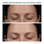 MENOLAE RESTORE® Dual-Wavelength Red Light Therapy For Perimenopausal Skin